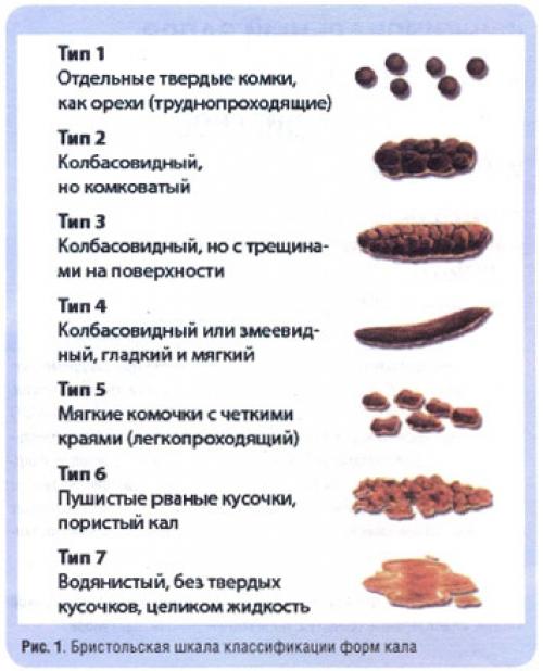 Необычные стулья в интерьере. Стулья в интерьере: 105 фото лучших вариантов дизайна и обзор современных новинок для интерьера 14